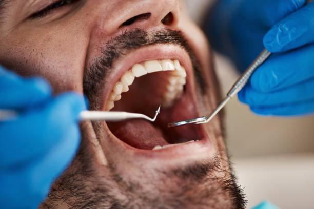 Best Chipped Tooth Repair Near Me  in Bridgeville, PA
