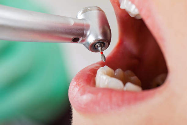 Best Tooth Pain Emergency Relief  in Bridgeville, PA
